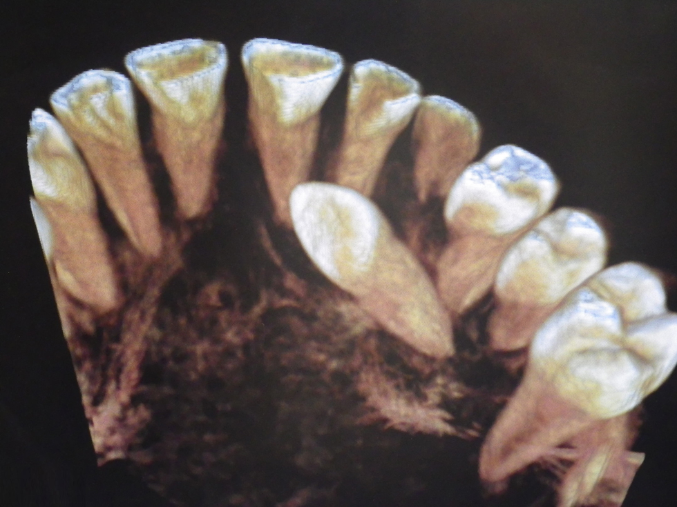 Michael-Riordan-Orthodontics-3d-xray-1